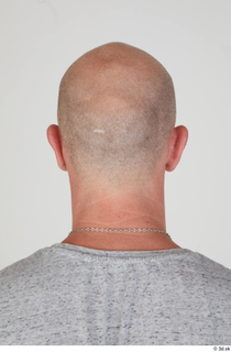 Photos Reece Griffiths bald head 0004.jpg